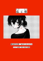 痣と痕